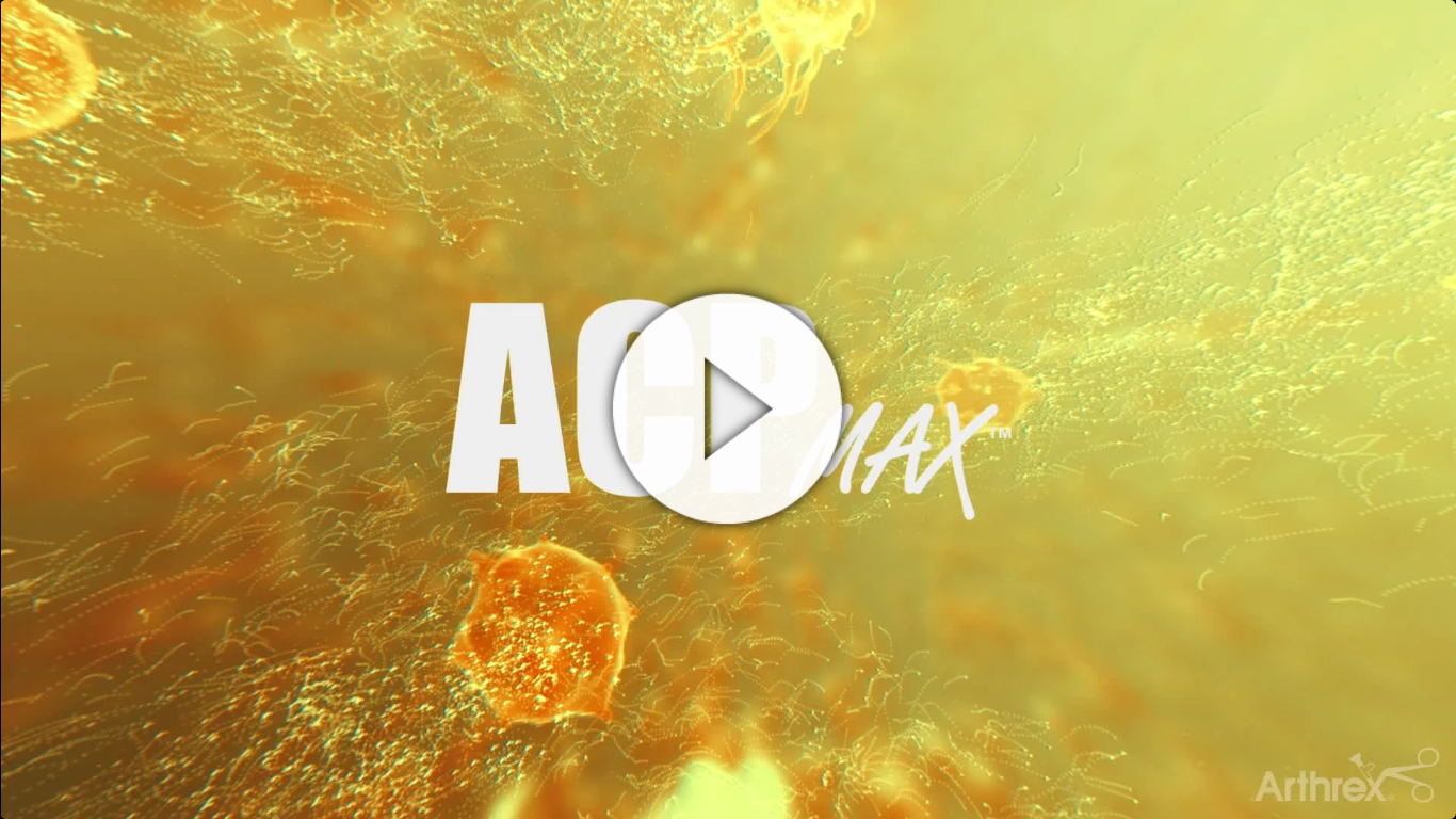 Arthrex ACP Max