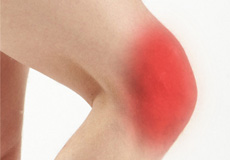 Anterior Knee Pain