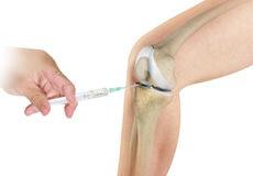 Anterior Knee Pain