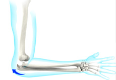 Thoracic Outlet Syndrome