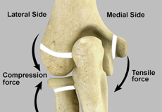 Thoracic Outlet Syndrome