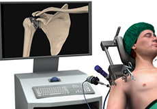 Minimally Invasive Shoulder Joint Replacement