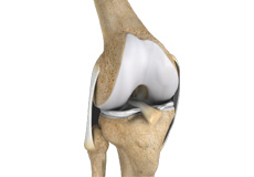 Anterior Knee Pain